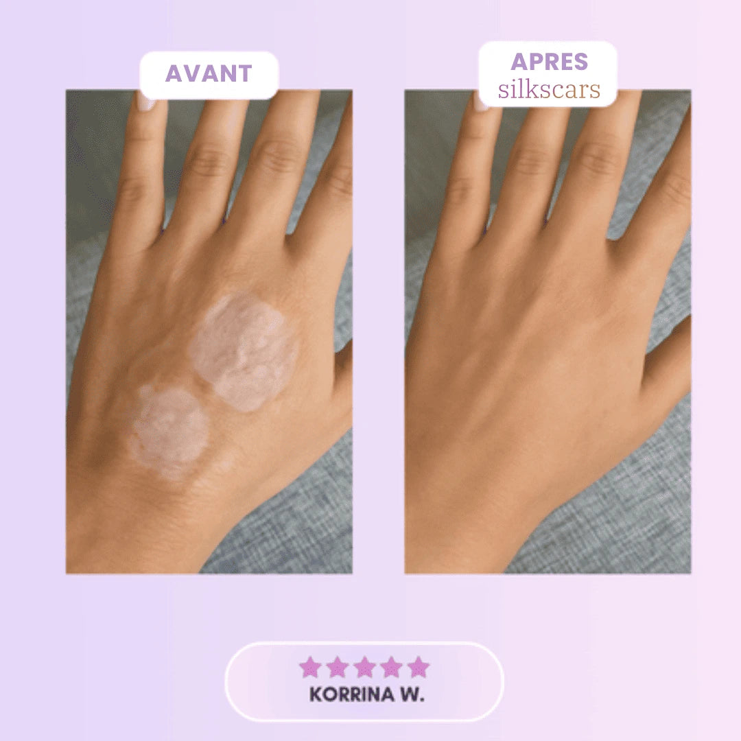 Silkscars Patch Anti‑Rides Collagène